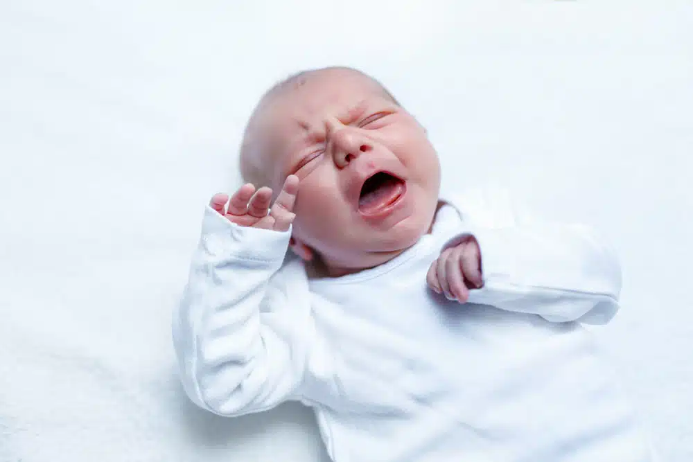 Acupuncture May Alleviate Babies' Excessive Crying (Infantile Colic)
