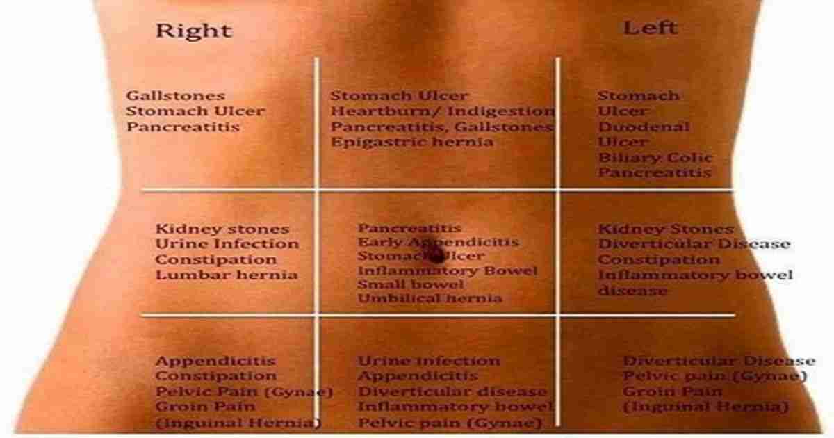 abdominal-pain-map-that-shows-what-could-be-the-cause-of-your-pain