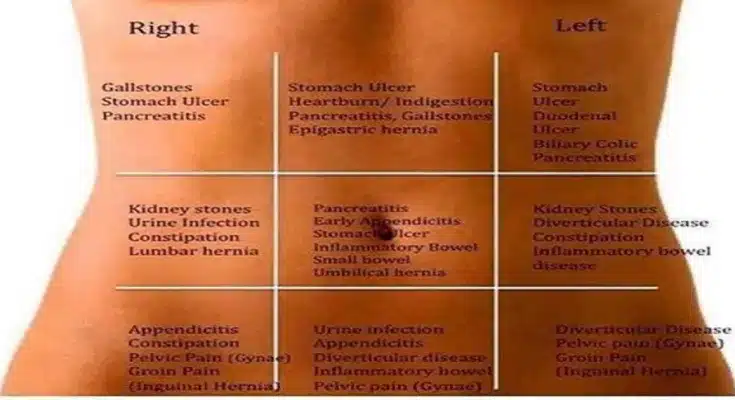 abdominal pain map abdominal pain map